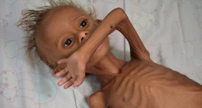 Acımasız vahşi kapitalizm her yeri sardı: 113 milyondan fazla insan açlıkla boğuşuyor