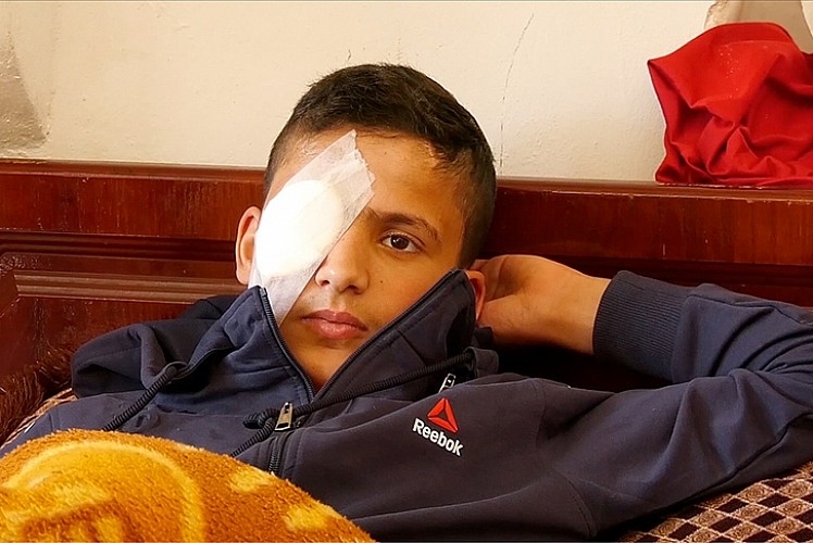 13 yaşındaki çocuk gözünü kaybetti!