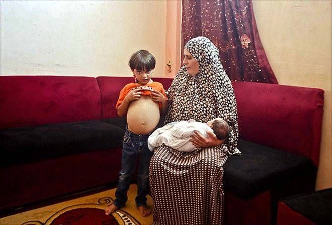 İSRAİL ABLUKASI GAZZELİ ÇOCUKLARI VURUYOR