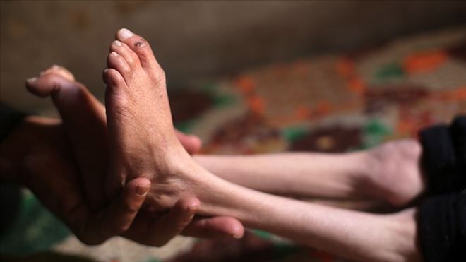 Türk Kızılayı Genel Müdürü Altan: İnsanların kemikleri artık sayılır hale gelmiş