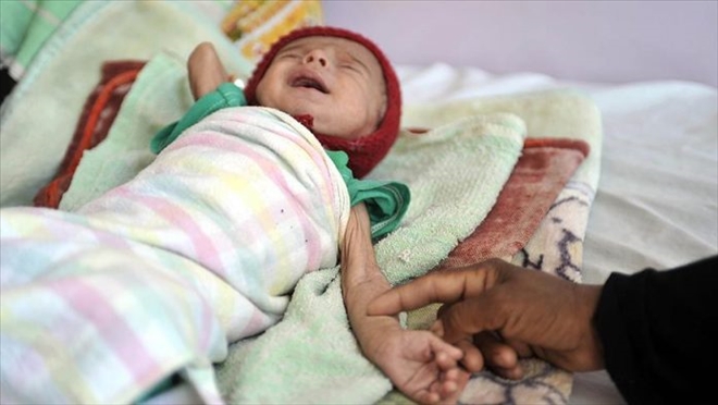 Yemen´de savaşın bilançosu ağırlaşıyor.. 10 milyon kişi ölebilir