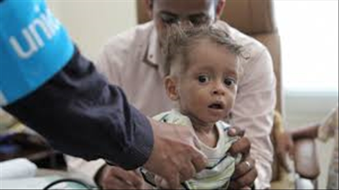 ´Yemen´de her iki saatte 1 anne ve 6 bebek ölüyor´